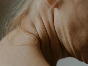 Врач Носарева: загар, курение и стресс ведут к преждевременному старению кожи